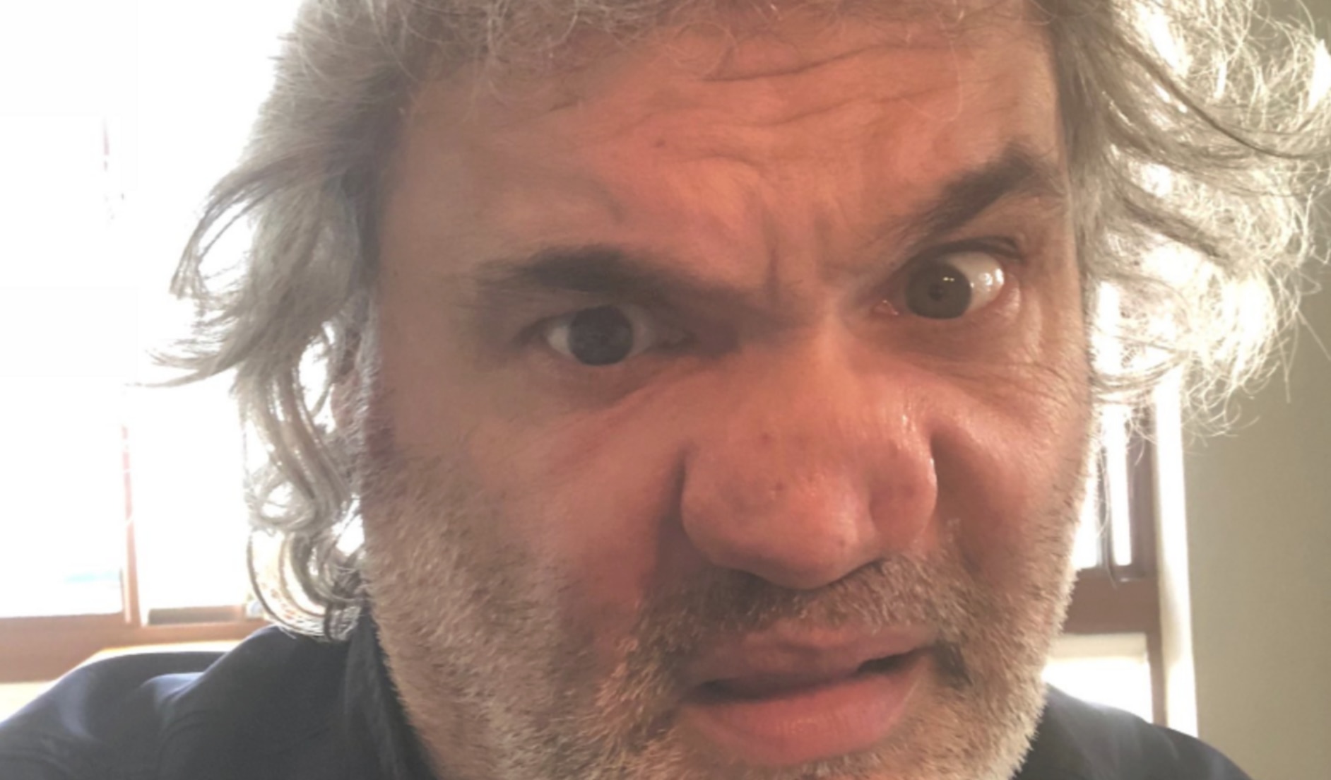Comedian Artie Lange Posts Photo Of 'Hideously Deformed' Nose, Th...