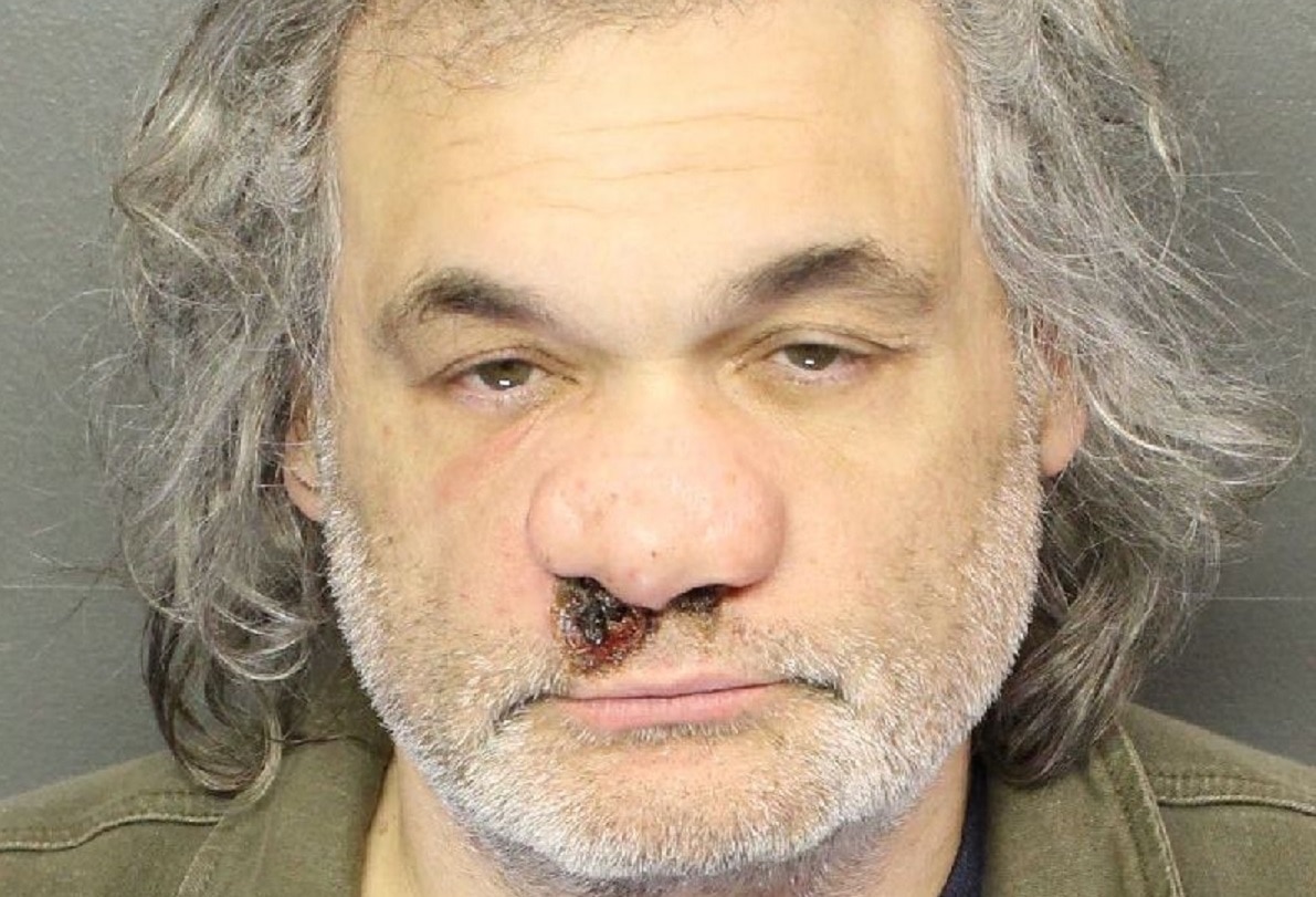 Artie Lange, a comedian who has publicly struggled with and openly discusse...